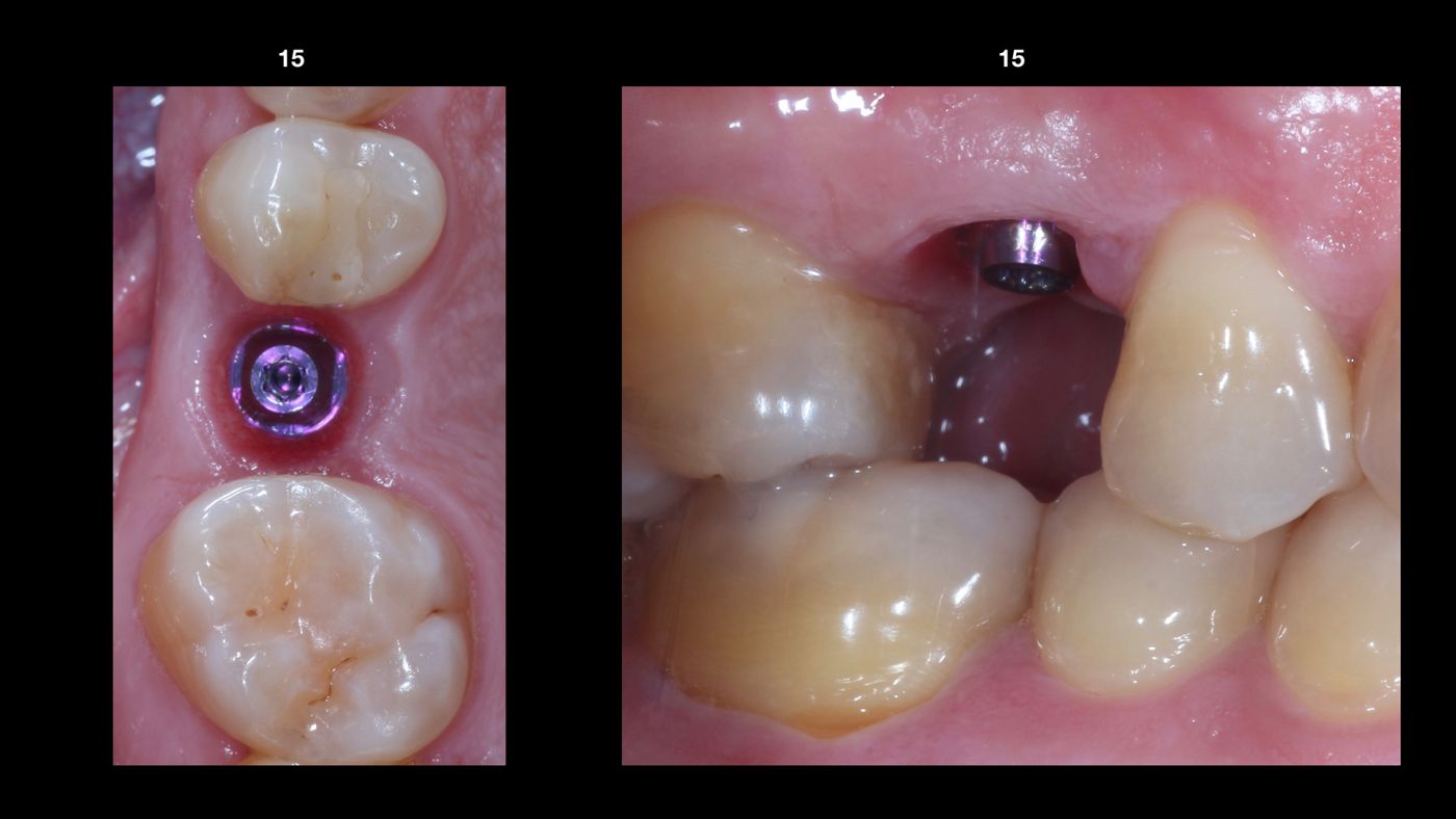fig. 11