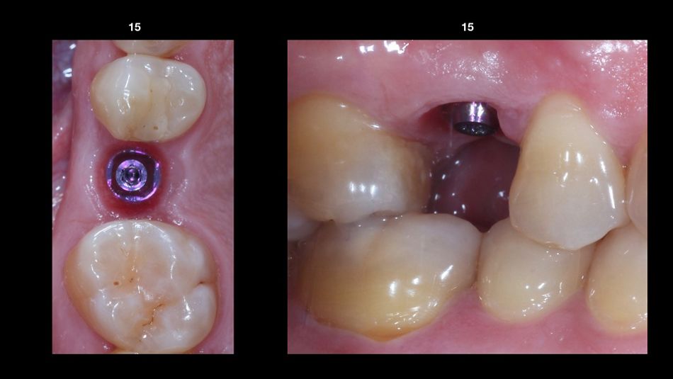 fig. 11