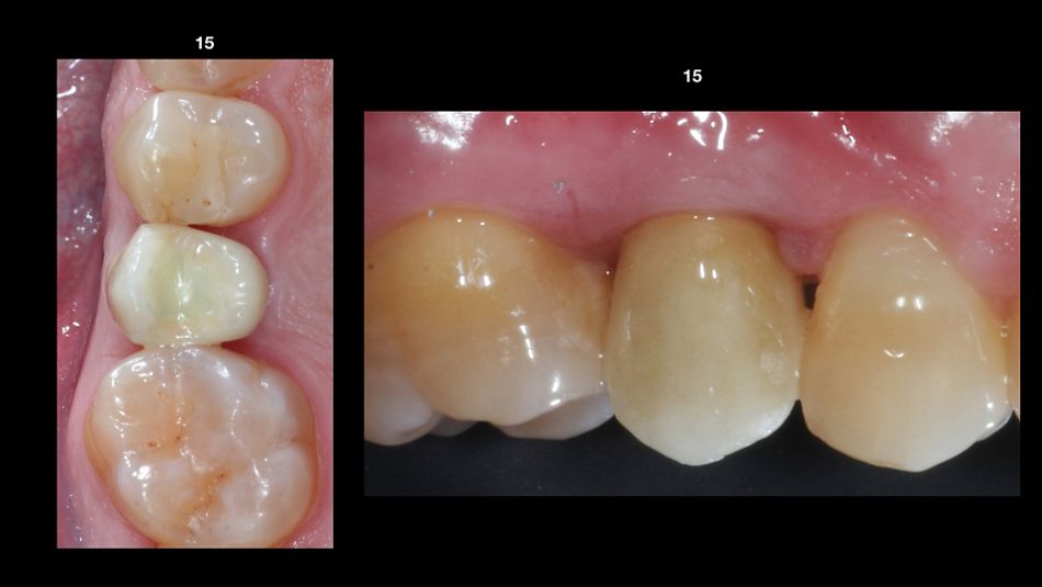 fig. 12