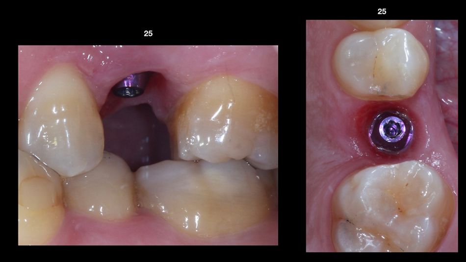 fig. 13