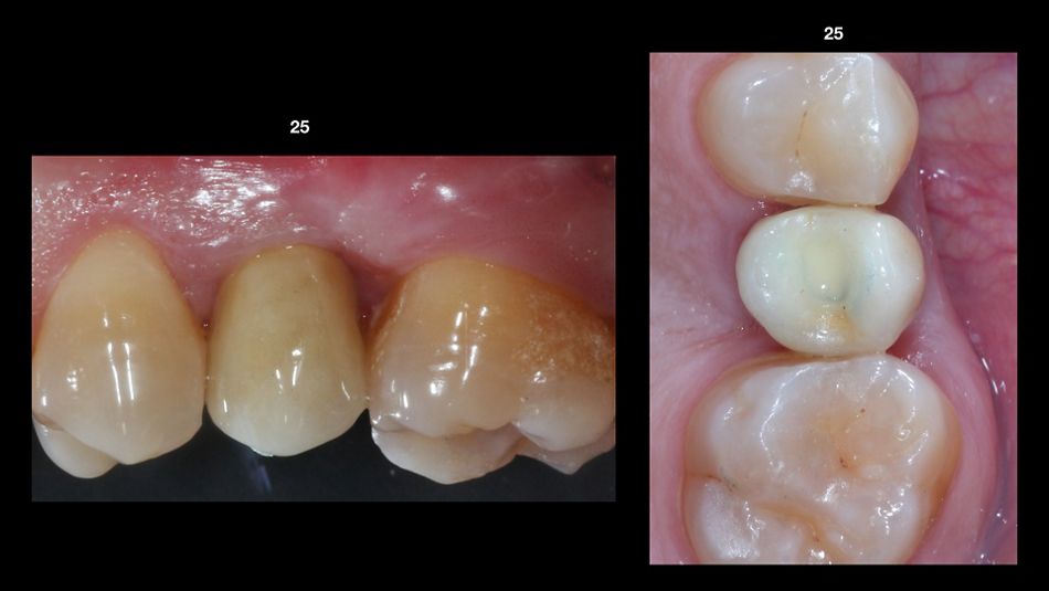 fig. 14