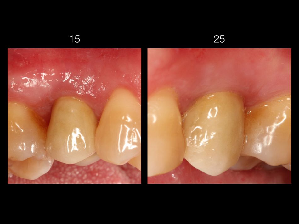 fig. 15