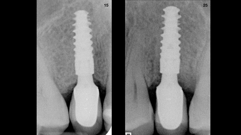 fig. 16