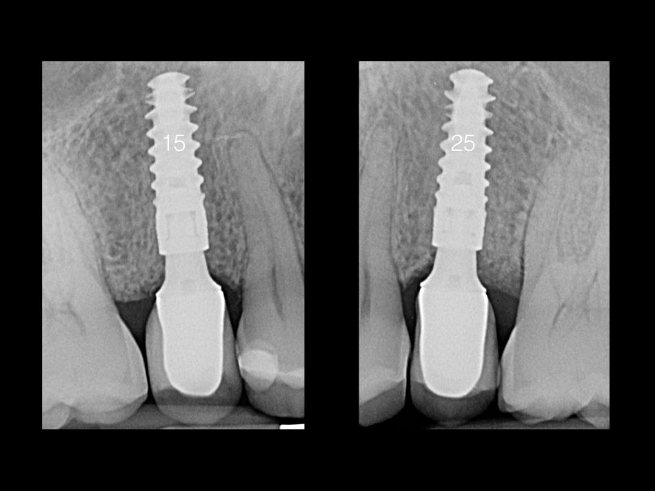 fig. 17