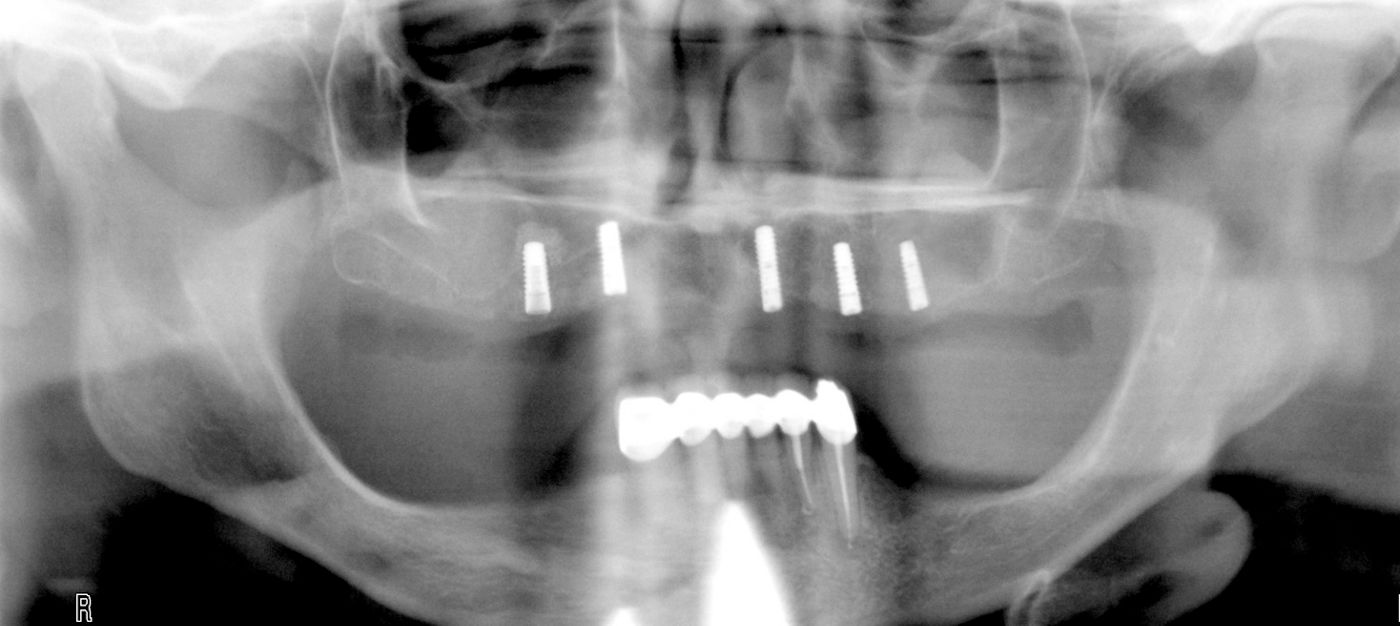 fig. 9