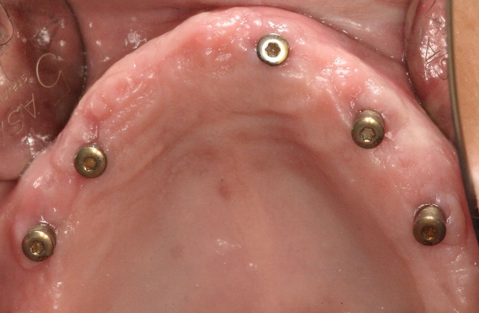 fig. 10
