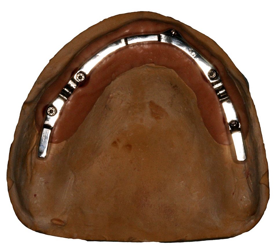 fig. 11