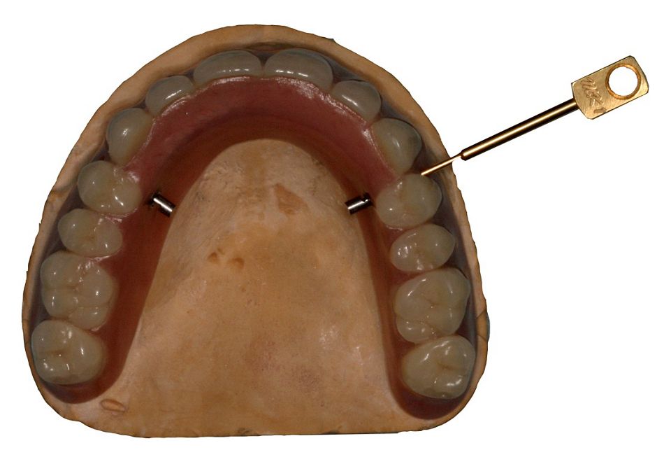fig. 12