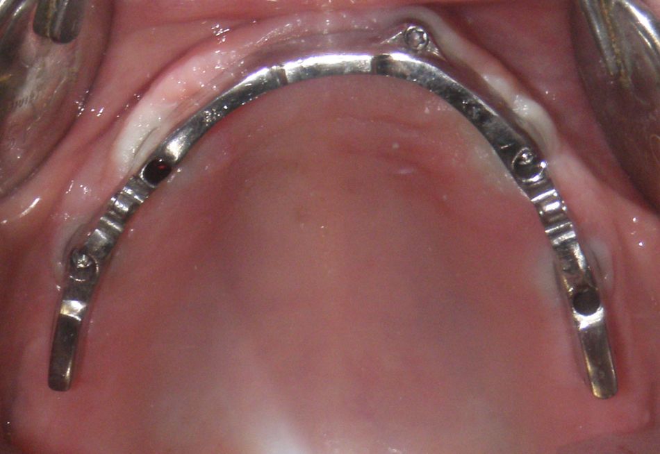 fig. 13