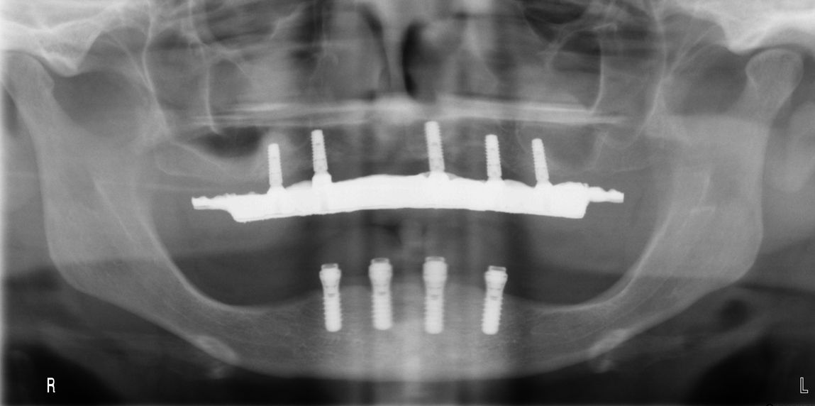 fig. 17