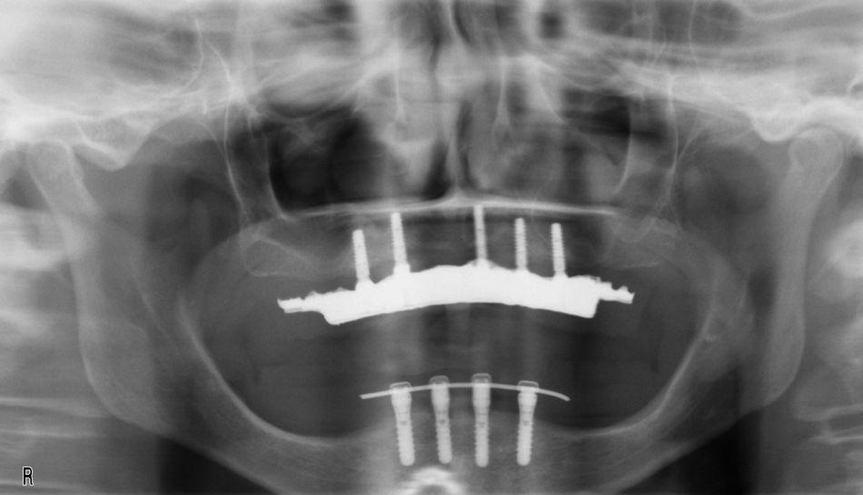 fig. 19