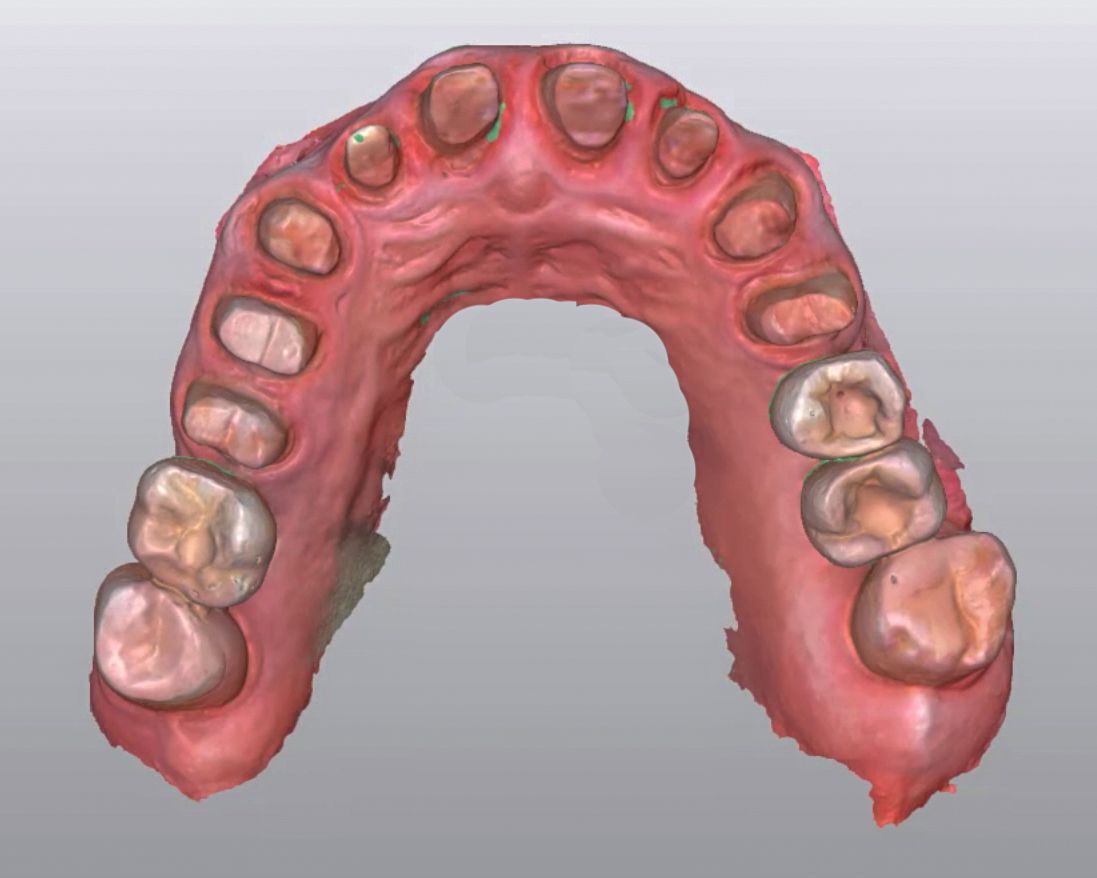 fig. 9