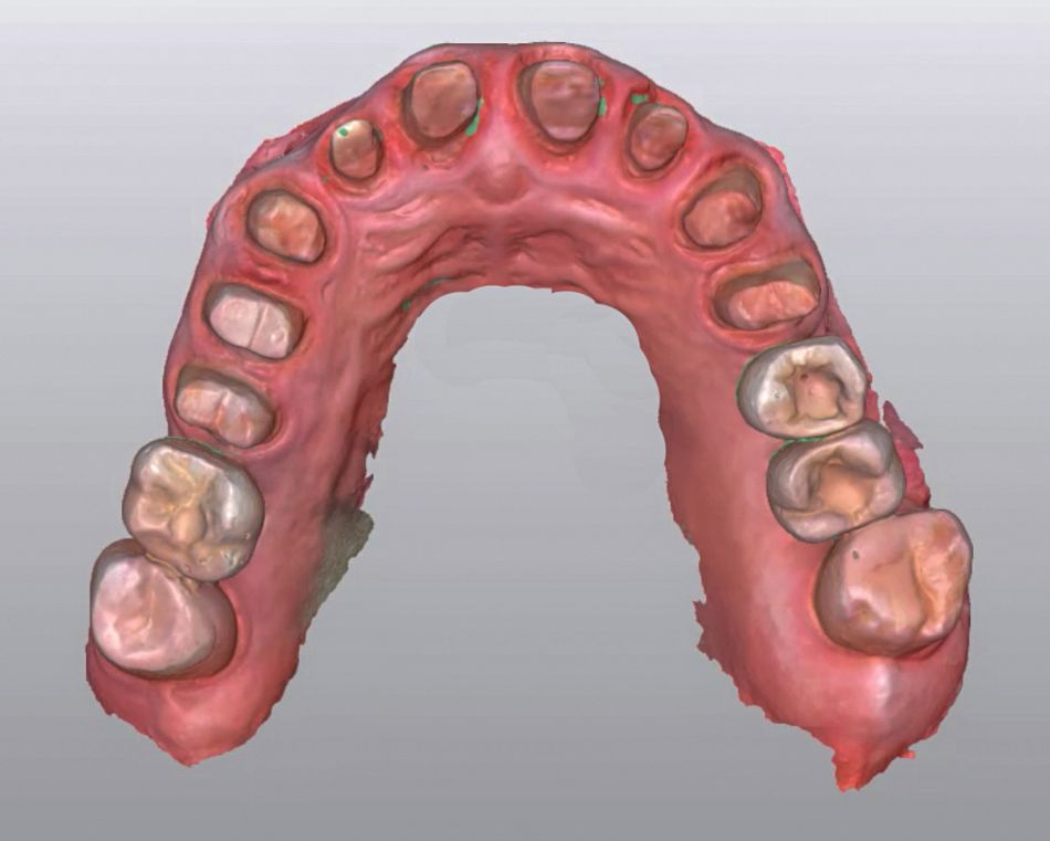 fig. 9