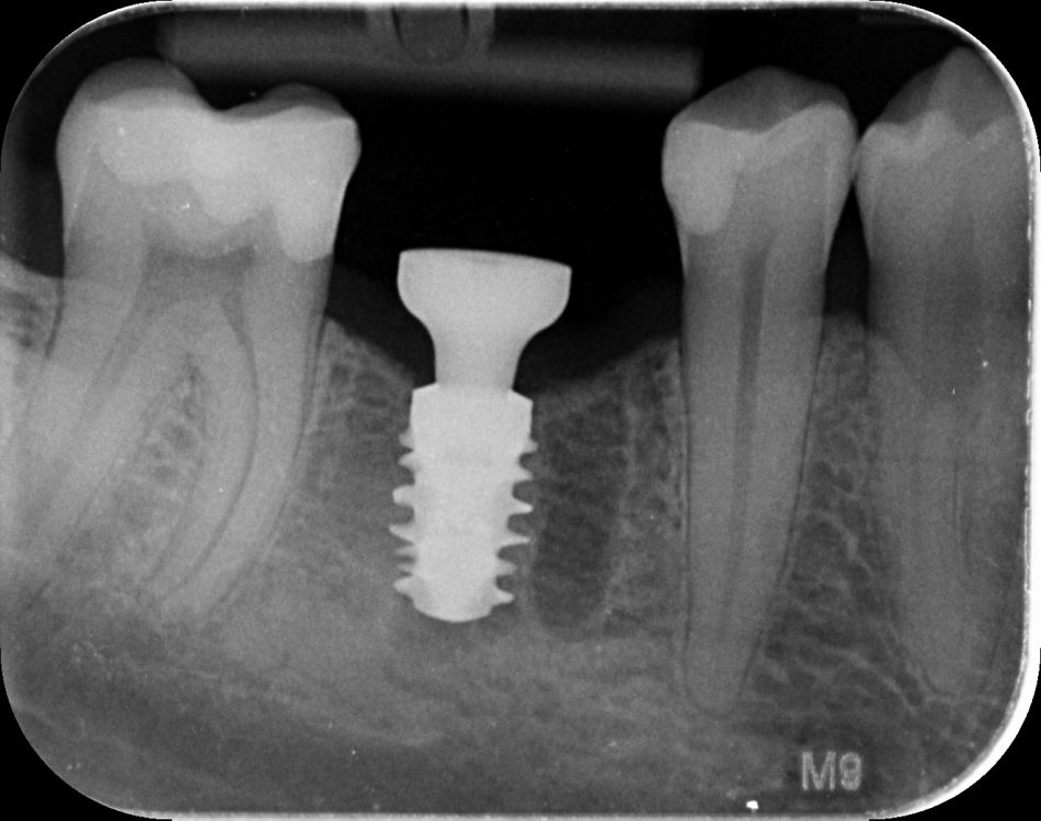 fig. 15