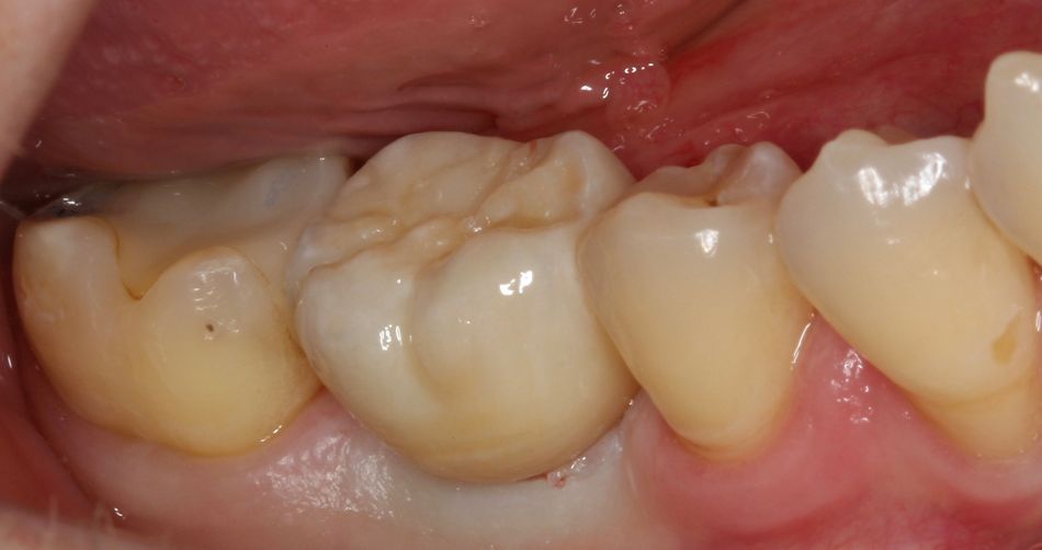 fig. 17