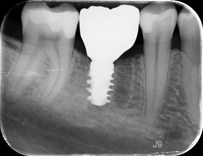 fig. 18
