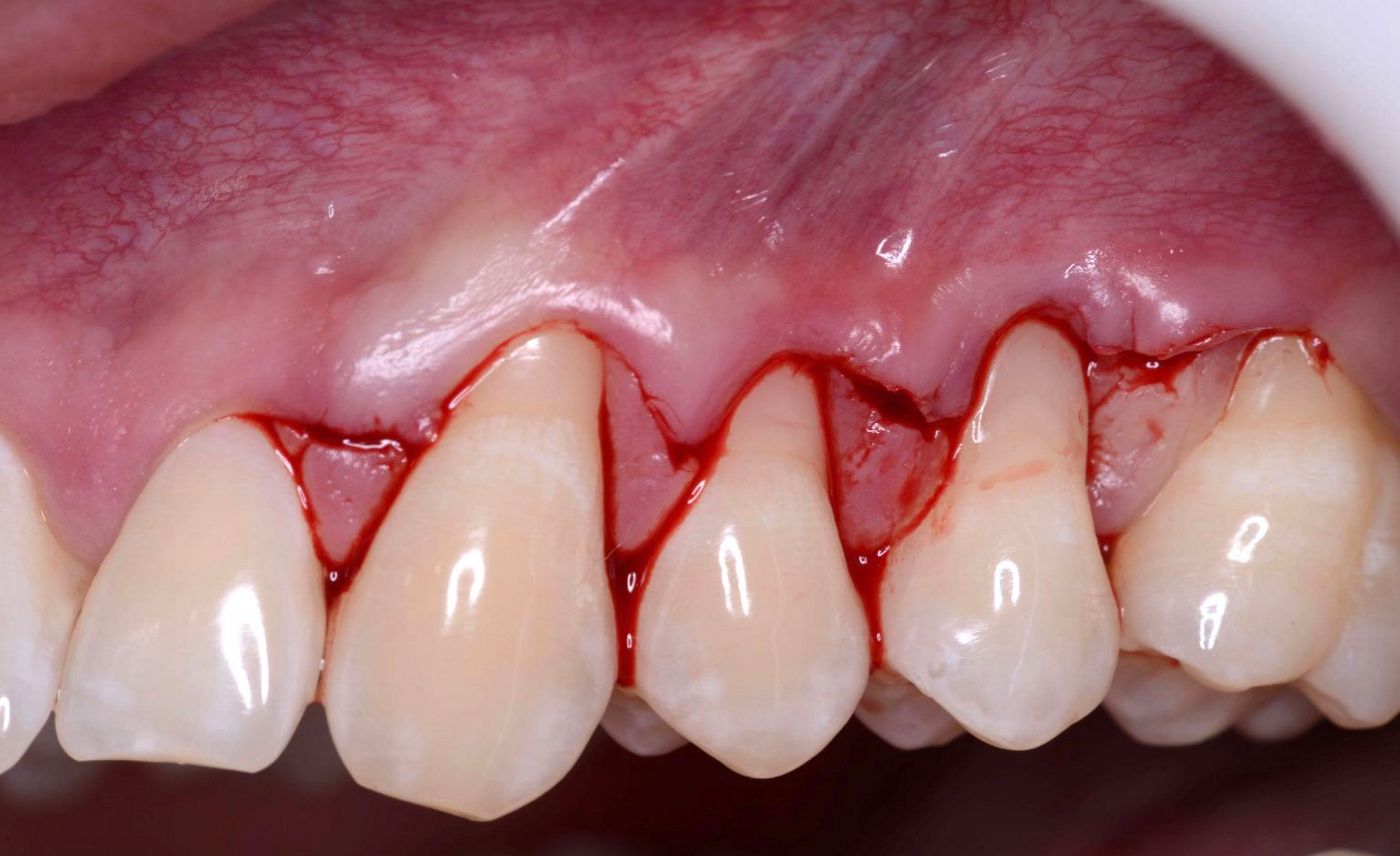 Fig 3. B