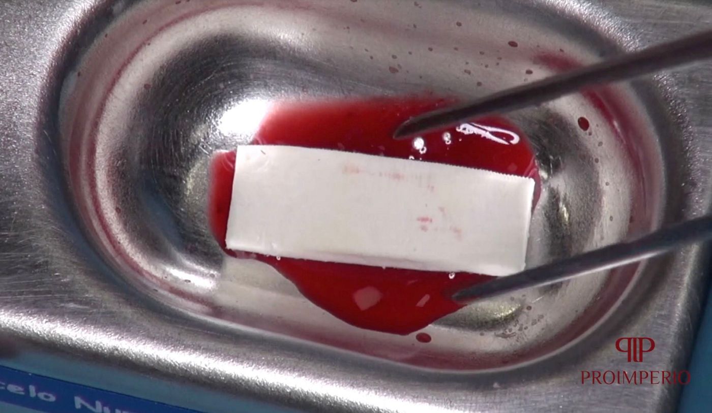 Fig 6. mucoderm® before hydration procedure, small perforations to facilitate the hydration, matrix after hydration