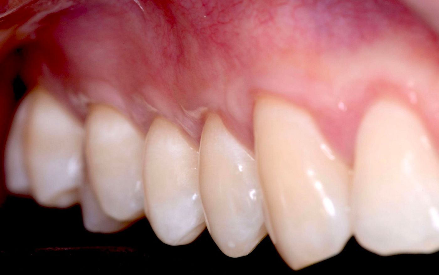 Fig 9C.  Right side