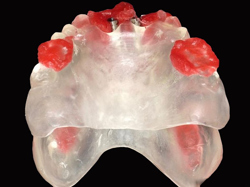 fig. 15