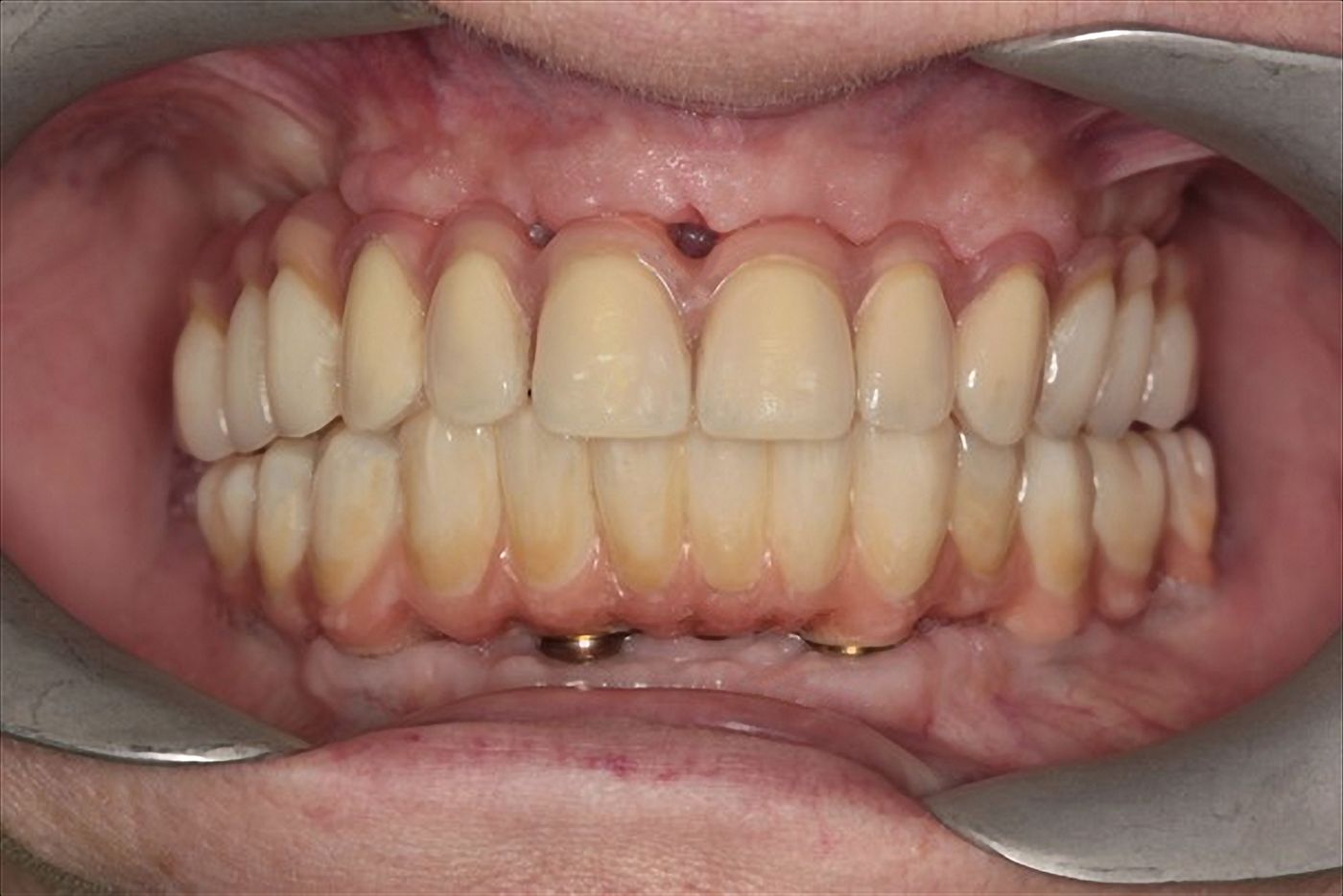 fig. 18