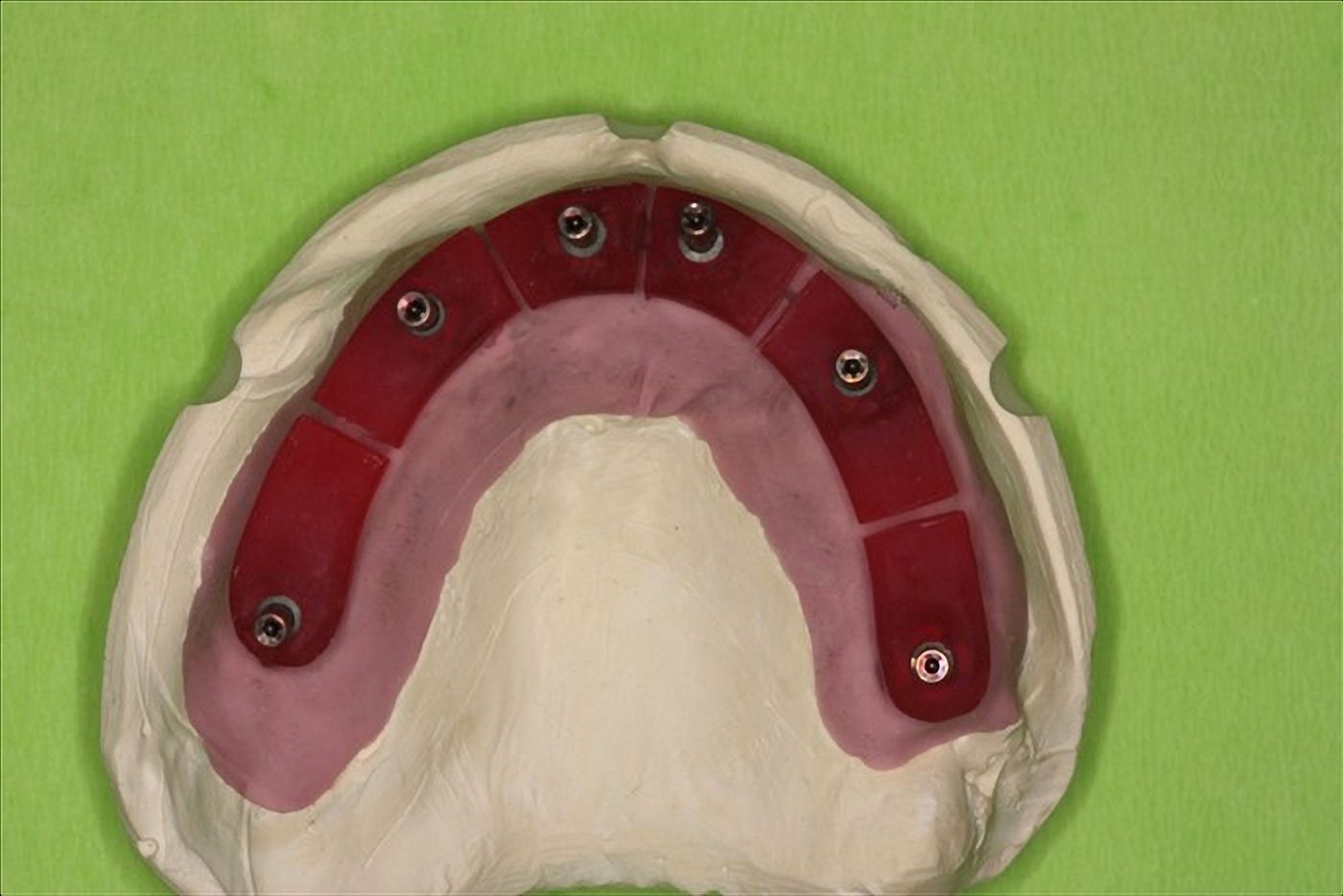 fig. 20