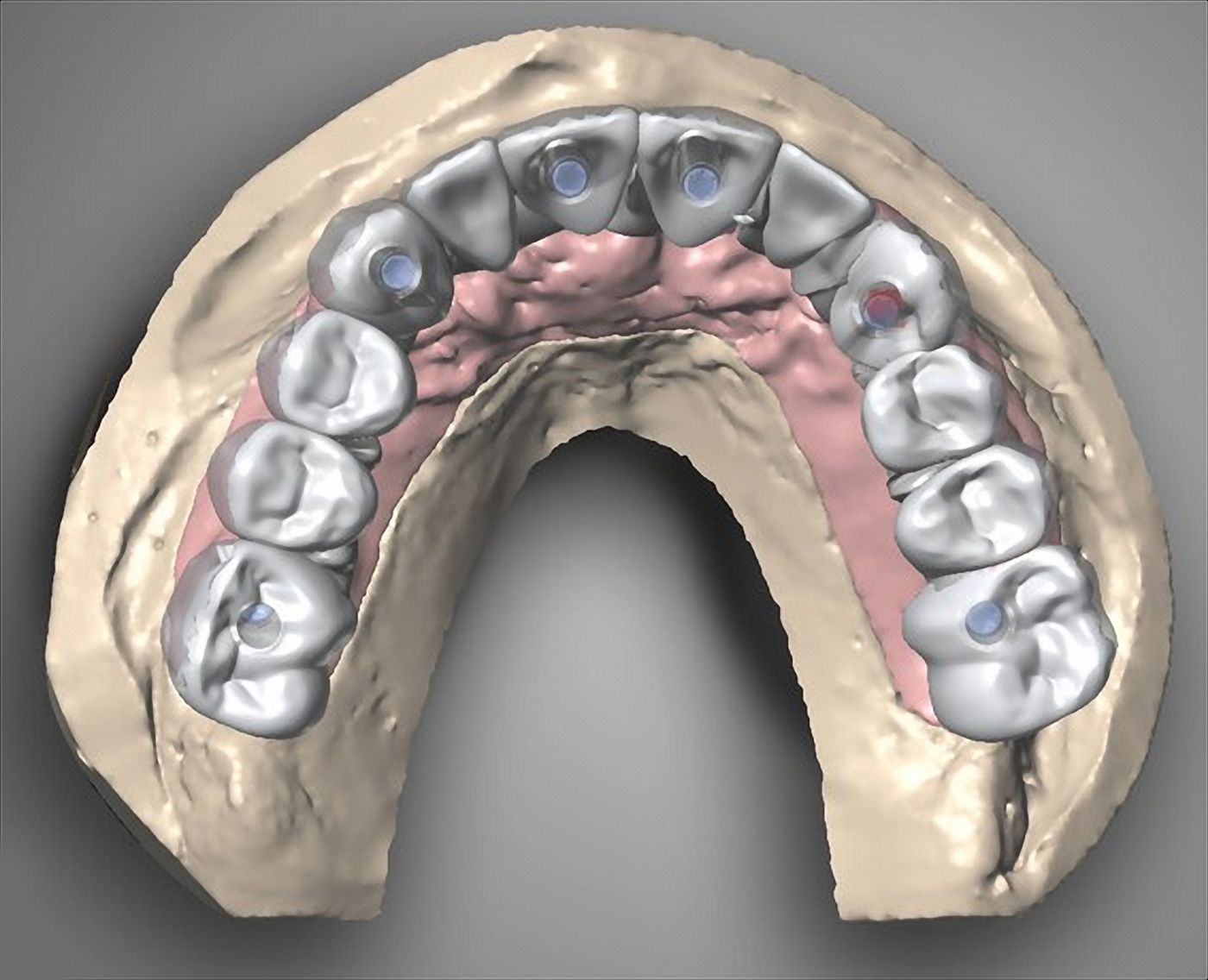 fig. 25