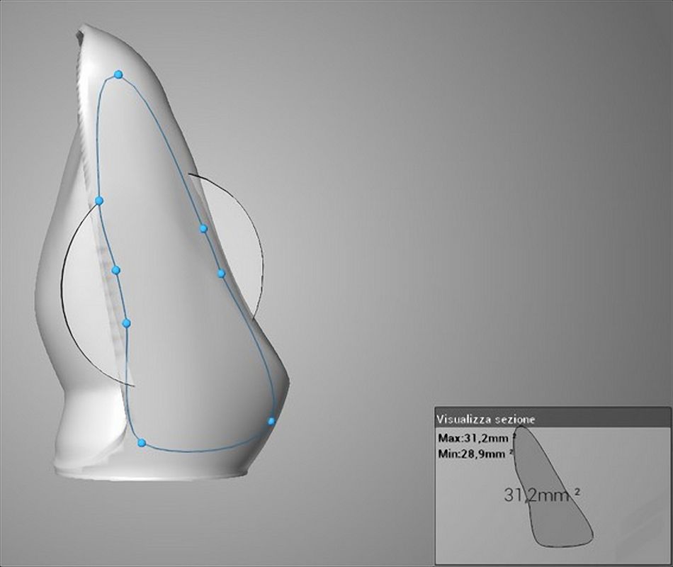 Fig. 26