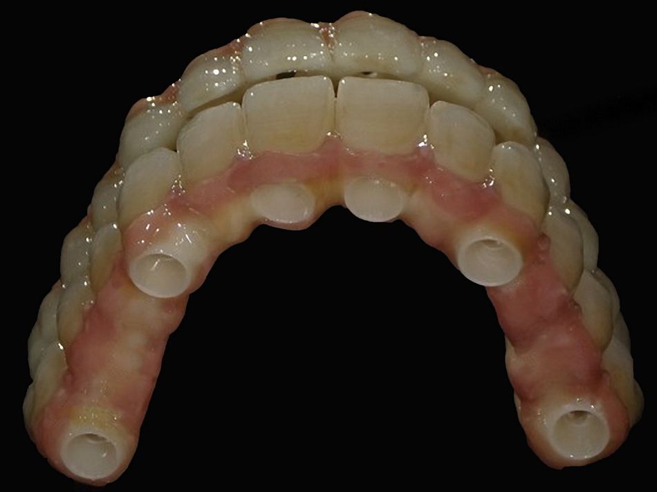 fig. 30