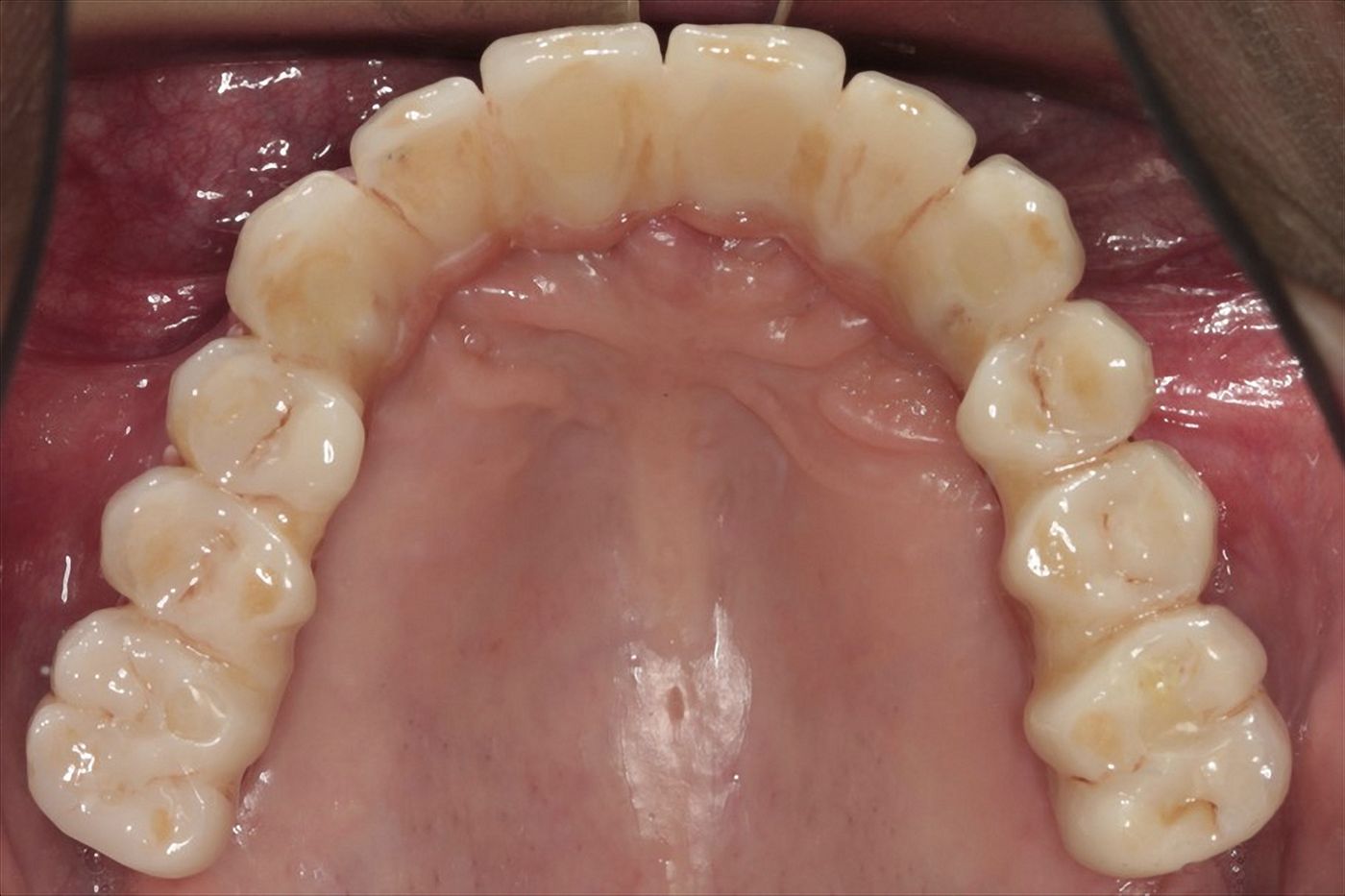 fig. 37