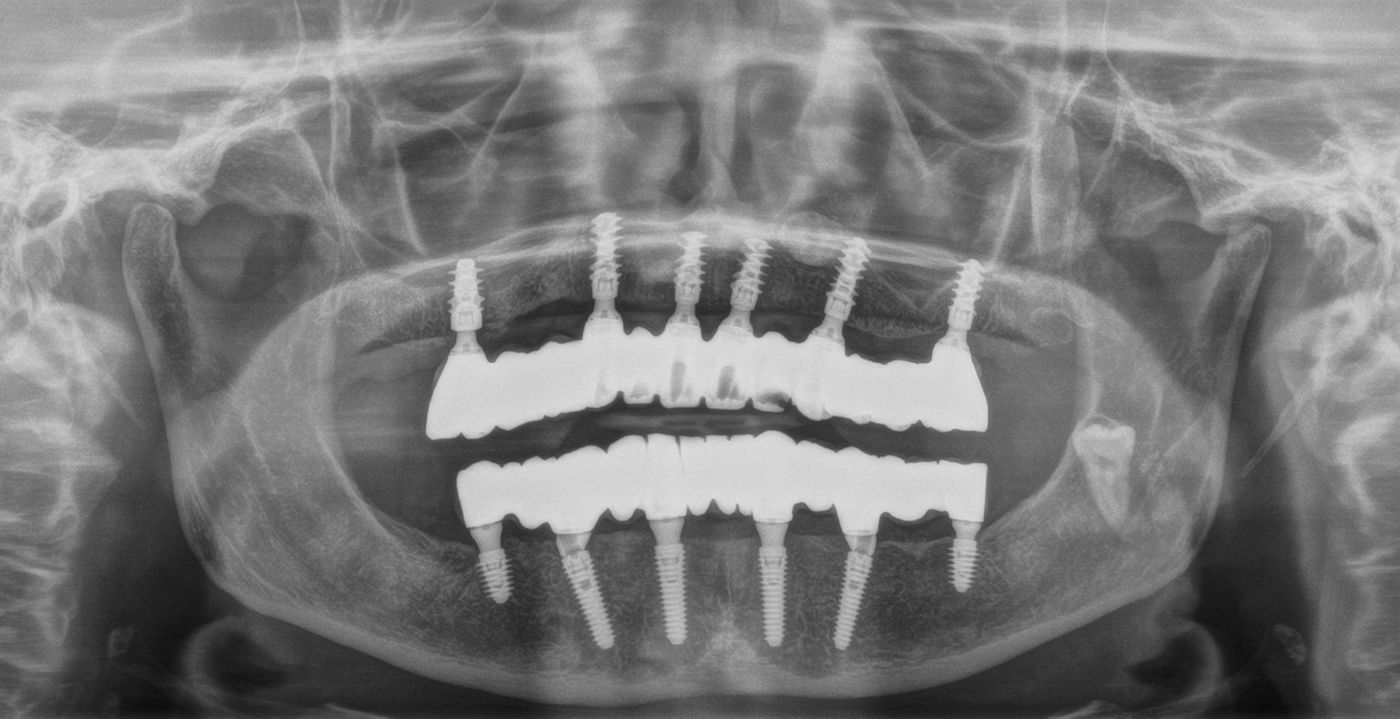 fig. 39