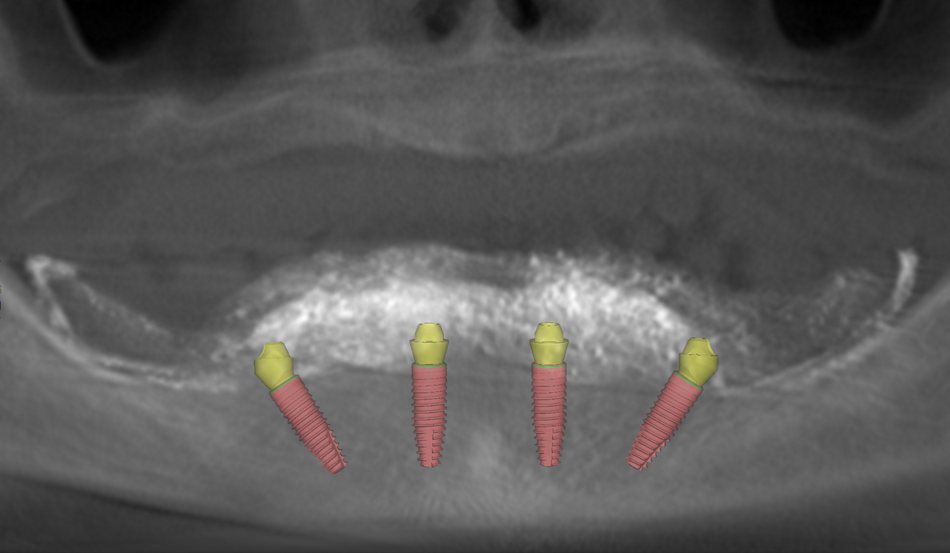 fig. 4