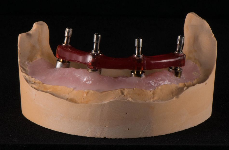 fig. 26