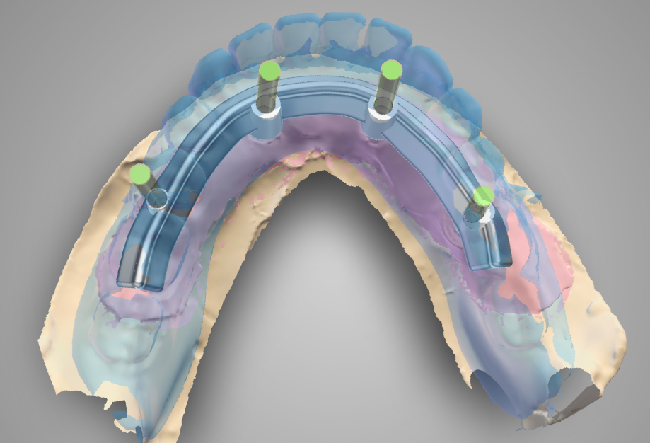 fig. 30