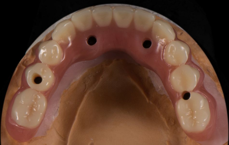 fig. 33