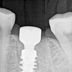 fig. 13