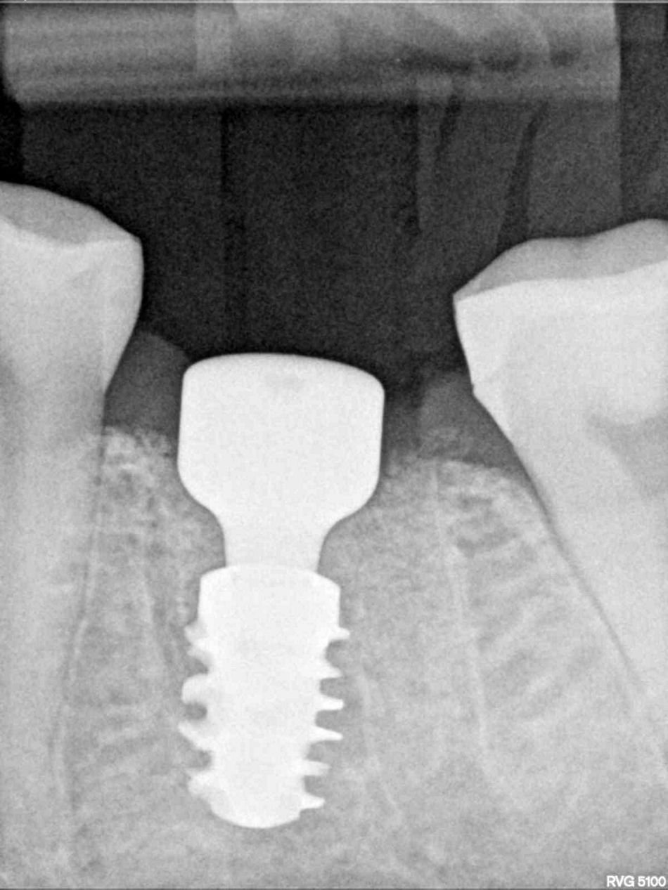 fig. 13