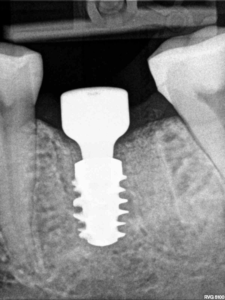 fig. 14