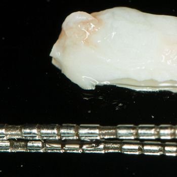 fig. 11