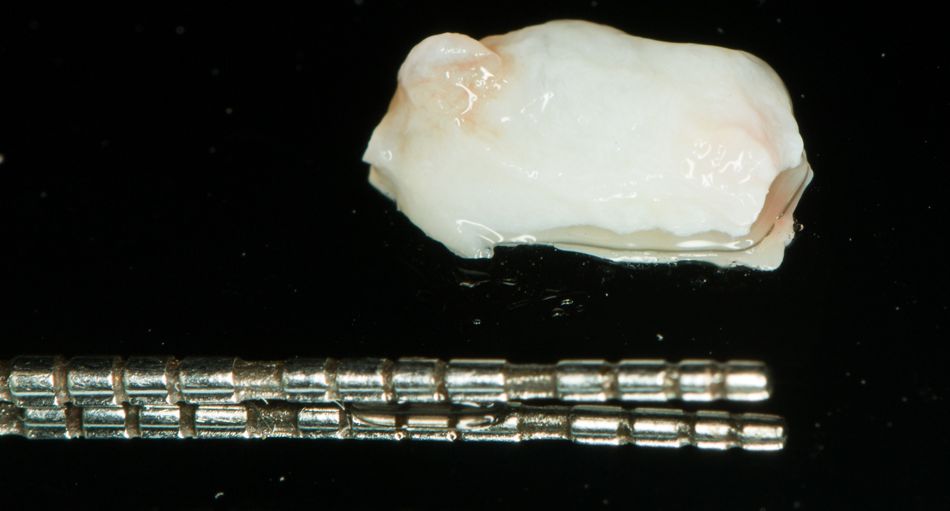 fig. 11