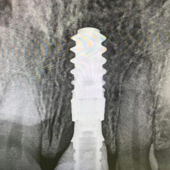 fig. 19