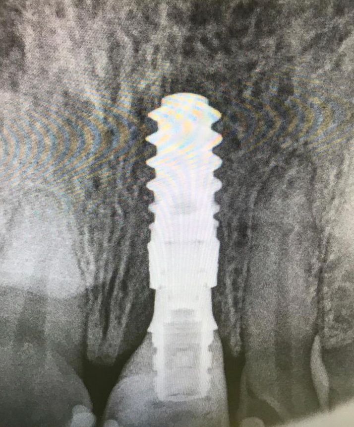 fig. 19