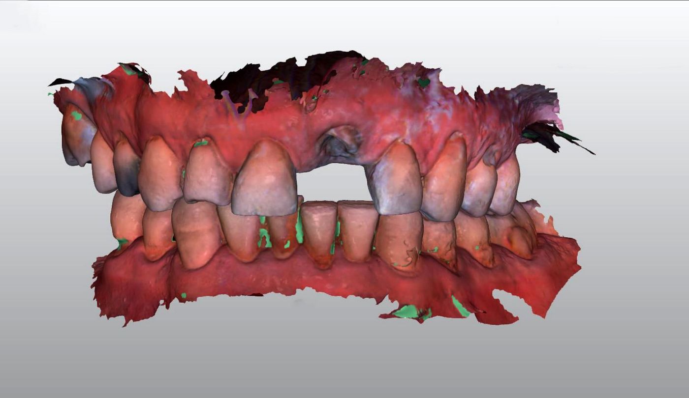 fig. 4