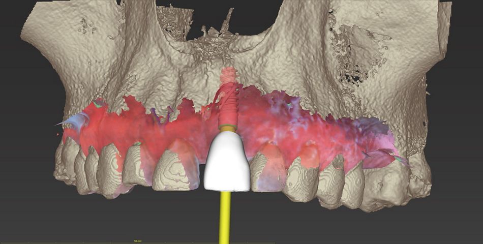 fig. 9