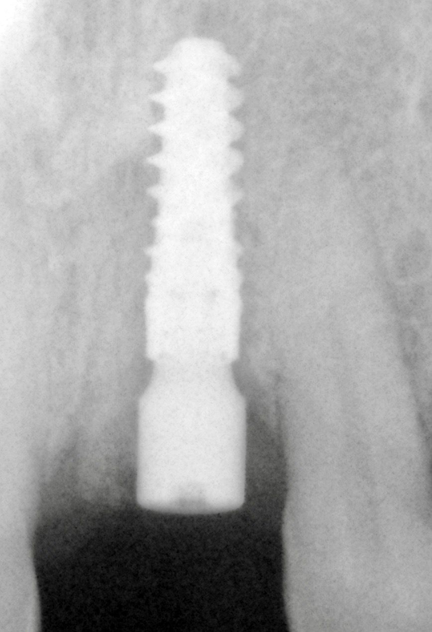 fig. 18
