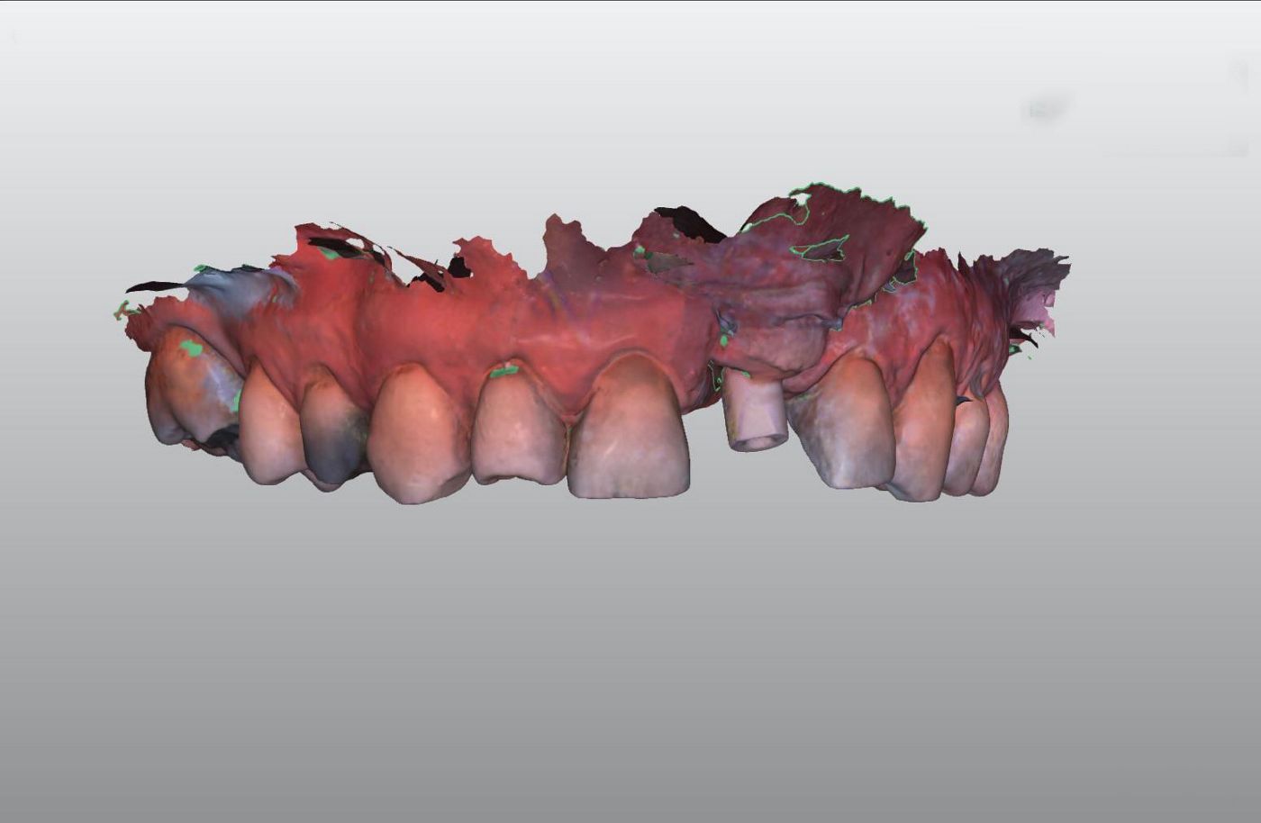 fig. 22