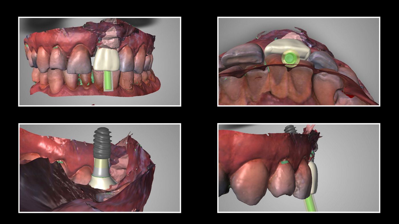 fig. 24