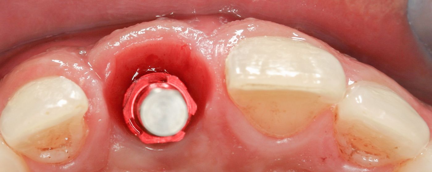 fig. 7a