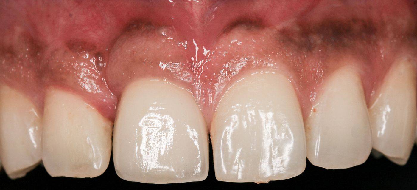 fig. 9a