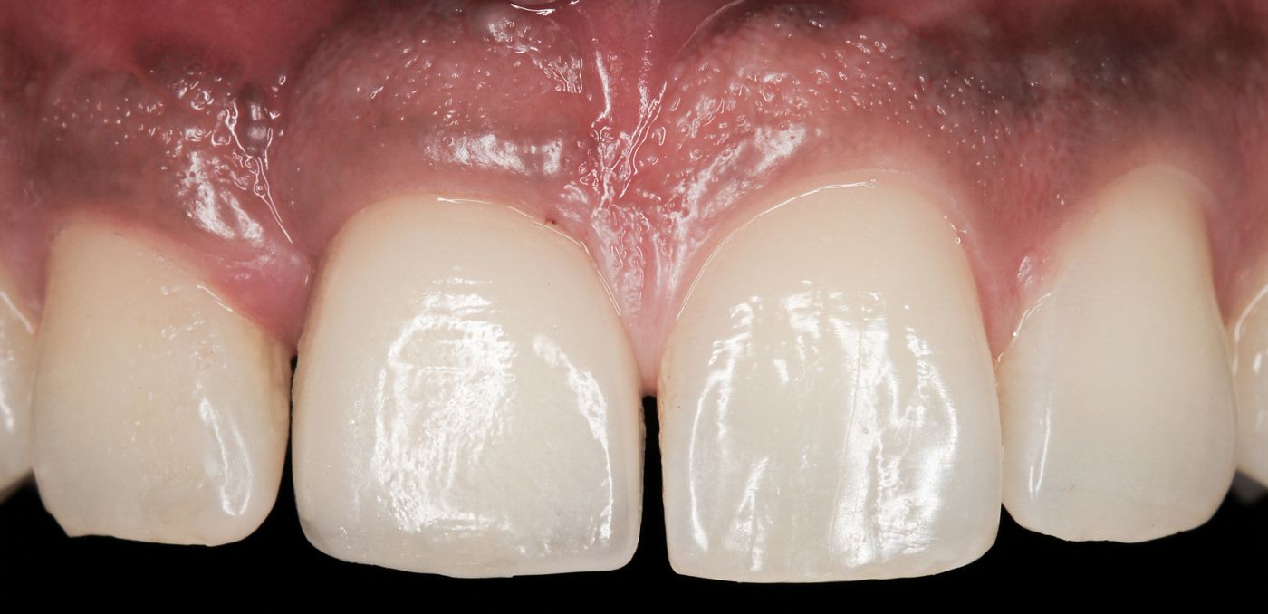fig. 10a